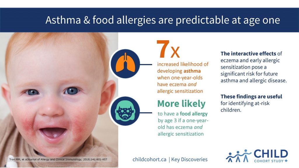 asthma-food-allergies-are-predictable-at-age-one-child-cohort-study