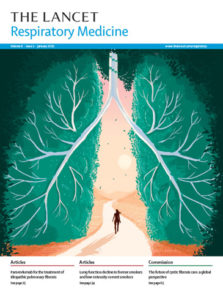 lancet